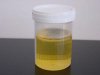 800px-Urine_sample_5.jpg