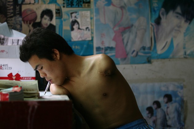 armless2-630x420.jpg