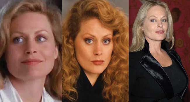 beverly-d-angelo-plastic-surgery-before-and-after-photos.jpg